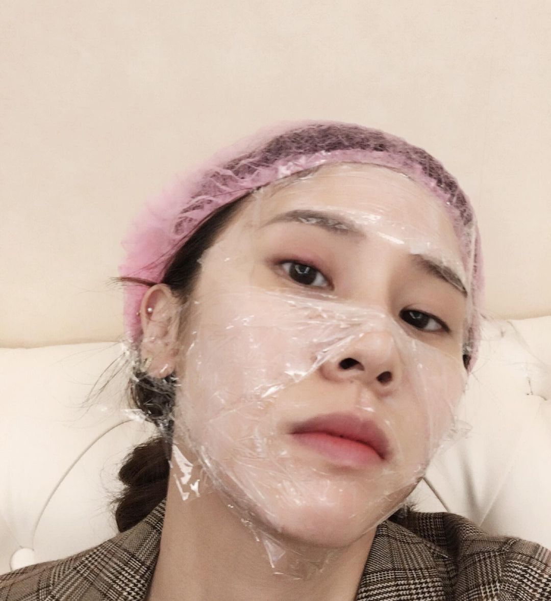 【皮秒雷射】星和診所-台南市-趁著去美洲前皮秒雷射_黃麻